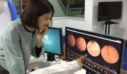 无痛胃镜全过程视频,轻松应对胃部检查